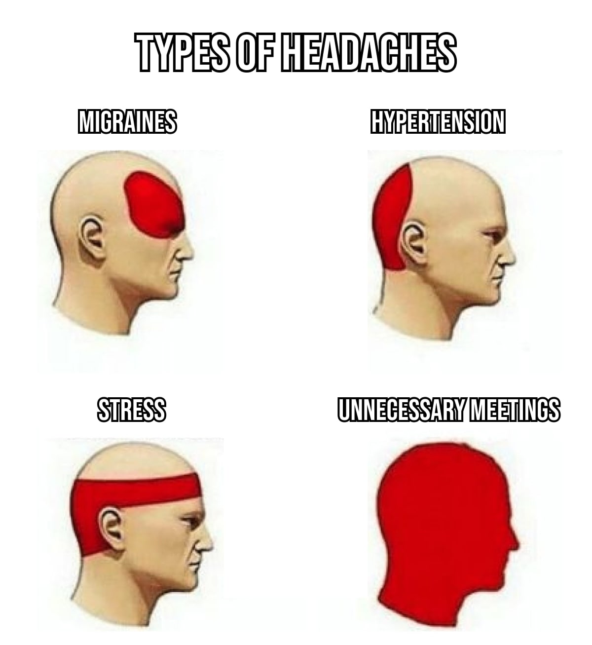types of headaches-min